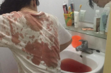 Cô gái bị giật túi xách 'suýt bỏ mạng' giữa phố Hà Nội