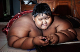 Hình ảnh những em bé béo nhất trên thế giới