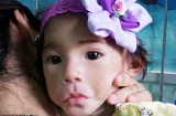 Bé gái 14 tháng chỉ nặng 3,5kg ở Sa Pa đã được xuất viện