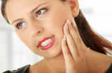 9 thói quen làm hại răng bạn cần bỏ gấp