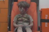 Bật khóc với hình ảnh cậu bé đầy bụi và máu trong xe cứu thương