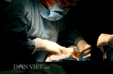 Ảnh độc về ca phẫu thuật em bé “mai rùa” ở Sóc Trăng