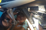 Bé gái 11 tháng tuổi nguy kịch vì mắc khăn quàng cổ vào nan hoa xe máy