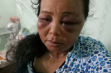 Trần tình của 2 phụ nữ bán tăm bị đánh đến ngất xỉu vì bị nghi bắt cóc trẻ em ở Hà Nội