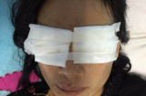 Điểm tin mới ngày 3/1: Quảng Bình, con dâu bị mẹ chồng tạt thẳng ca axit vào mặt