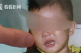 Sai lầm của cha mẹ khi nằm điều hòa khiến bé trai 2 tuổi bị liệt mặt, méo miệng
