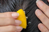 1001 mẹo hữu ích dưỡng tóc mềm mượt, chắc khỏe nhờ 1 quả chanh