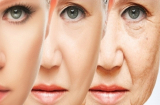 Những nguyên nhân khiến da mặt bị lão hóa và có nếp nhăn