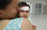 Thương xót: Bé gái 2 tháng tuổi bị khỉ cào rách mặt
