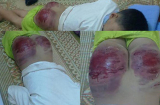 Đang điều tra vụ ông bố đánh đánh con 13 tuổi tứa máu ở Thái Nguyên