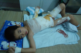 Thương tâm: Trượt chân ngã vào chảo dầu sôi, bé trai 6 tuổi nguy kịch