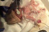 Điểm tin 30/10: Xúc động Em bé chào đời trong bọc ối sống sót kỳ diệu nhờ... chiếc túi nilon
