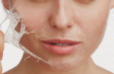 Dưỡng da mùa đông cho da khô như thế nào để da sáng mịn và khỏe mạnh?