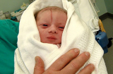 Kinh hoàng: Bác sĩ bất cẩn rạch trúng đầu bé sơ sinh trong lúc mổ đẻ