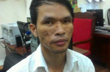 Vụ bé trai bị hành hạ dã man: Bắt nghi can ngay tại Sài Gòn