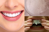 Mẹo đơn giản tẩy trắng răng hiệu quả ngay tại nhà ai thử cũng thành công