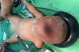 Xót xa: Bé trai tử vong vì bị cha ném ly trúng đầu