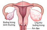 Clip: 9 căn bệnh ung thư phụ nữ Việt dễ mắc phải nhất