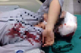 Vụ nữ sinh bị đánh gãy tay, ngất xỉu ngay tại cổng trường: Lời trần tình kinh hãi của nạn nhân