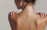 Vị trí nốt ruồi 'án ngữ' trên tấm lưng ngọc ngà của phụ nữ nói nên điều gì?