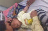 Thương tâm: Bé 3 tuổi bị bỏng nặng do ăn nhầm bột hóa chất