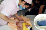 Trẻ sơ sinh bị hoại tử ruột vì thói quen pha sữa chết người này của cha mẹ