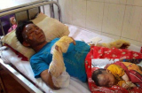 Nổ khí gas, 10 người trong một gia đình ở Lào Cai bị bỏng nặng