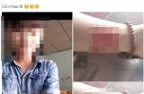 Bị người yêu chia tay, nữ sinh 16 tuổi quay clip rạch tay đăng lên mạng xã hội