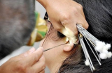 Lấy ráy tai khi đi cắt tóc, gội đầu: Nữ sinh năm nhất nhập viện vì thói quen tưởng như vô hại này