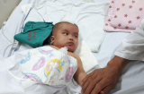 Bé gái 6 tháng tuổi bị chấn thương sọ não nguy kịch do ngã võng