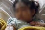 Cảnh báo GẤP: Liên tục xem tivi và ipad trong dịp nghỉ hè, bé gái 6 tuổi lên cơn động kinh và liệt tay trái