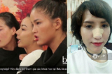 Thí sinh Vietnam Next Top Model 2017 tiết lộ bất ngờ về việc bị đánh gãy mũi