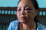 Toàn cảnh vụ việc 2 người phụ nữ bán tăm bị người dân Sóc Sơn đánh trọng thương do nghi bắt cóc trẻ em