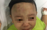 Vụ bé trai 1 tuổi bị bạo hành nghiêm trọng: Công an 'giăng lưới' 5 đối tượng tại bệnh viện