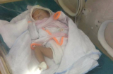 Xót xa cảnh bé gái sinh non nặng 1,4kg bị mẹ bỏ rơi tại bệnh viện