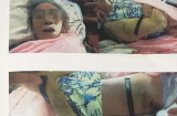 Điểm tin mới 13/11: Phẫn nộ cụ bà 93 tuổi bị người làm đánh đập, bắt ngửi giấy chùi phân