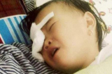 Bé gái 2 tuổi bị gà chọi đá mù mắt: 'Giống gà chọi nhưng không được đi đá chọi bao giờ'