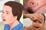 Khi con SỐT, cha mẹ tuyệt đối đừng làm 10 điều này để tránh nguy hại cho con