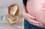 Mang thai 3 tháng cuối có nên uống nước dừa không?
