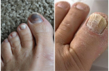 Bắt bệnh chuẩn xác qua dấu hiệu bất thường ở bàn chân mà ai cũng bỏ qua khiến sức khỏe tồi tệ hơn.