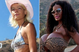 Phát hoảng người mẫu ngực khủng nhất Châu Âu tiêm thuốc nhuộm để thành da đen