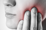 Hướng dẫn cách phòng ngừa bệnh viêm miệng