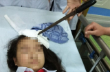 Nguy hiểm: Nam sinh lớp 7 phóng dao làm thủng đầu bạn gái cùng lớp
