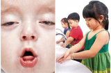 Nguyên nhân và cách phòng tránh bệnh viêm đường hô hấp ở trẻ nhỏ