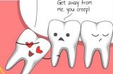 Răng khôn mọc dại: Những biến chứng nguy hiểm khó lường