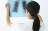Những biểu hiện của bệnh bụi phổi atbet (amiăng)?