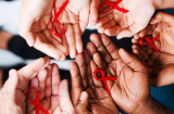 Dấu hiệu nhận biết bệnh HIV