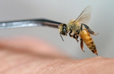 Sử dụng nọc ong trị bệnh, một người phụ nữ tử vong
