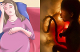 5 dấu hiệu báo động đỏ trong thai kỳ mẹ phải đi khám ngay