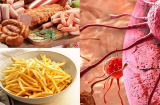 10 loại thực phẩm càng ăn càng “nuôi” ung thư